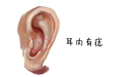 耳朵这些地方有痣，富贵加身，一辈子不差钱