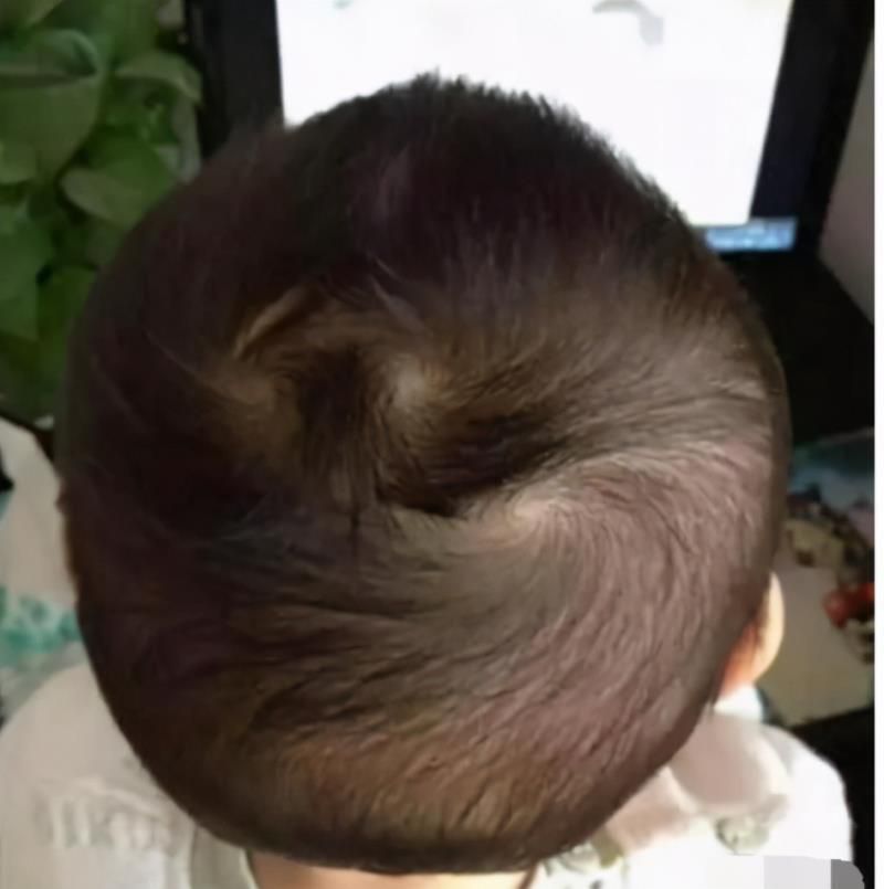 “双旋男孩找不到，双旋女孩没人要”，孩子头上的旋有啥讲究
