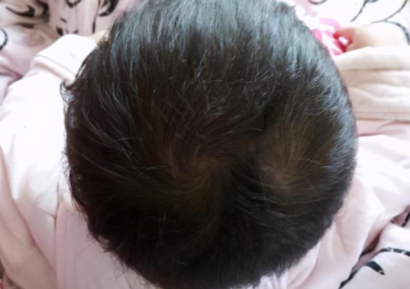 “双旋男孩找不到，双旋女孩没人要”，孩子头上的旋有啥讲究