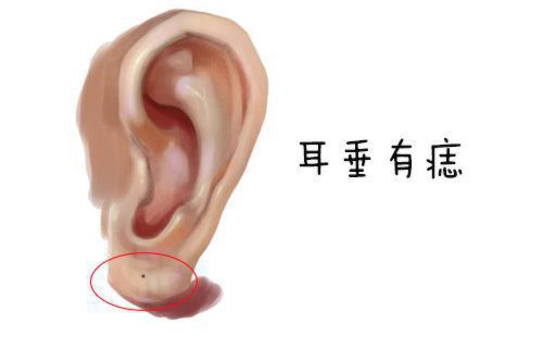 耳朵这些地方有痣，富贵加身，一辈子不差钱