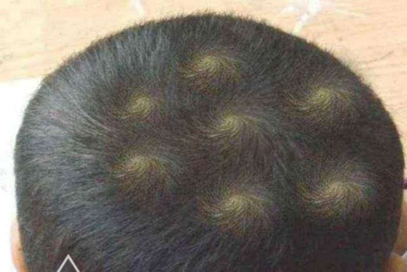 孩子的头顶有两个“旋”暗示更聪明？一个科学实验告诉你答案