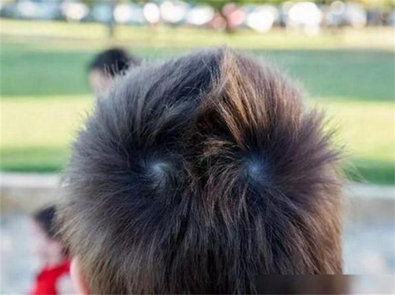 孩子的头顶有两个“旋”暗示更聪明？一个科学实验告诉你答案