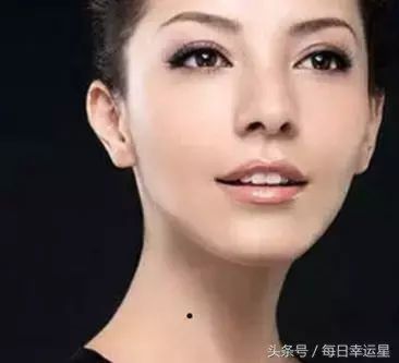 女人这几个地方张痣，大多生活衣食无忧，顺顺当当！