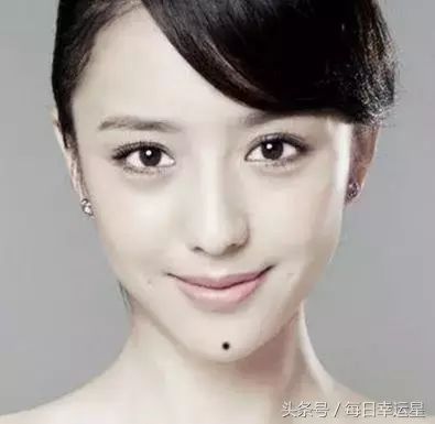 女人这几个地方张痣，大多生活衣食无忧，顺顺当当！