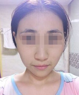 脸上长这痣的人，千万要点掉，否则一生难发大财