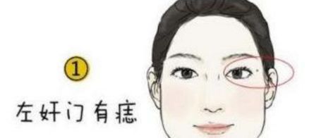 脸上长这痣的人，千万要点掉，否则一生难发大财