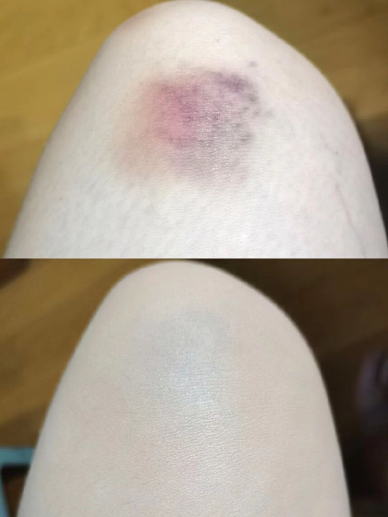 遮瑕膏哪个牌子好遮斑效果好干皮，遮瑕推荐遮斑第一名