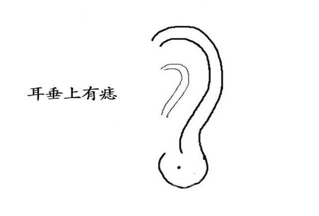 深度解读耳朵上面的痣