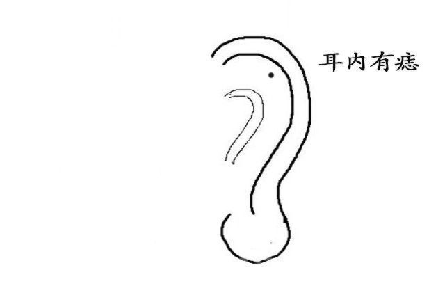 深度解读耳朵上面的痣