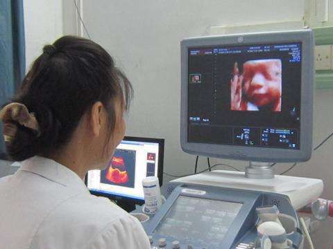 四维女宝生下来却是男宝，四维翻盘可能是这3个原因