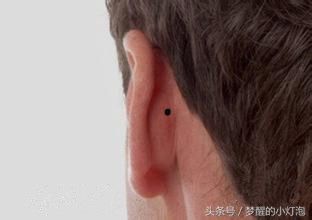 3种罕见痣相注定命中贵人多，时机一到必会发横财