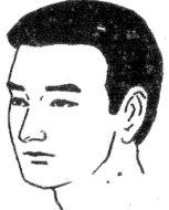 女人右眼下眼睑中间有痣图解，面部痣好坏一览表