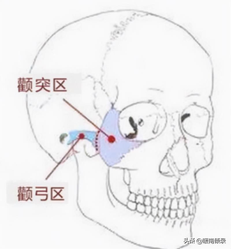 伏羲骨有几种图片，伏羲骨与凸额头区别