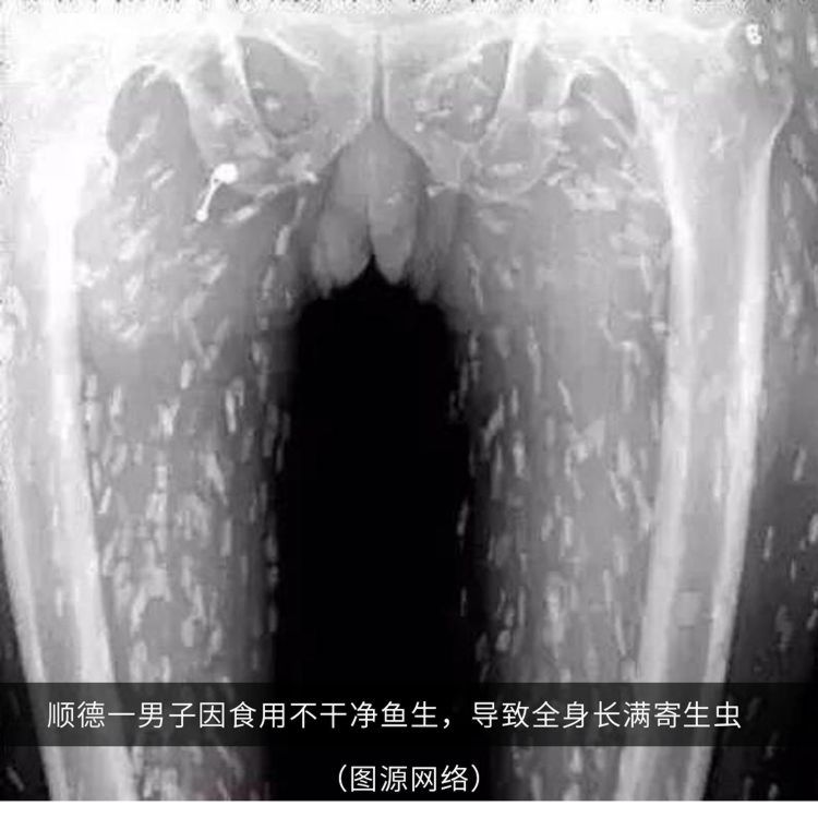 26种恐惧症测试图，5秒吓死人的照片