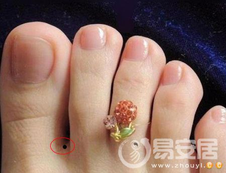 女人脚底板长痣的痣相图解，女人右脚底有痣的命运图
