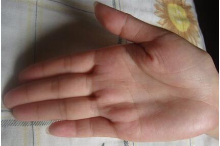 下垂眉毛面相，双下巴风水面相