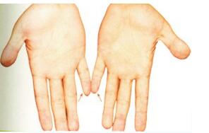 小拇指短代表什么意思，小指短的手相算命