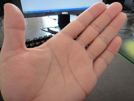 什么是人字掌纹,手纹是人字掌代表什么 什么是人字掌纹,手纹是人字掌代表什么