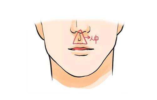 人中无沟是什么意思，人中那条沟叫什么