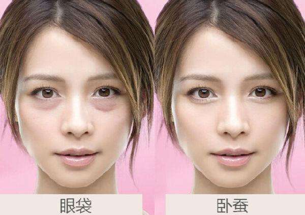 卧蚕眼是什么,卧蚕和眼袋的区别图 卧蚕眼是什么,卧蚕和眼袋的区别图