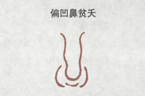 偏凹鼻卜易居,挺鼻子和塌鼻子对比照 偏凹鼻卜易居,挺鼻子和塌鼻子对比照