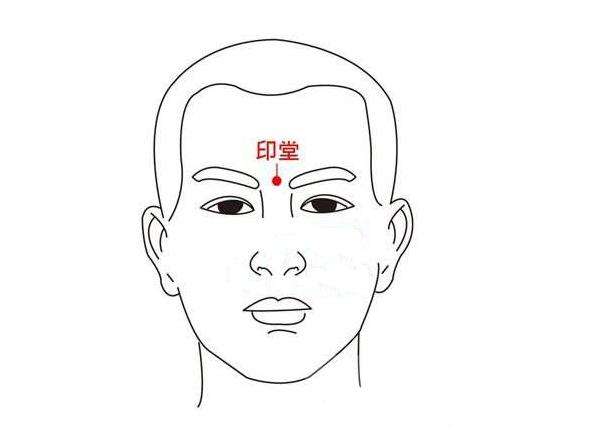 印堂有胎记好不好呢，印堂有红色胎记代表什么