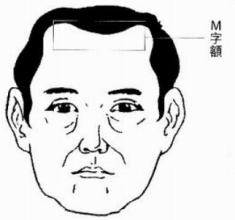M字型额头女人的面相，男人额头m字型好不好