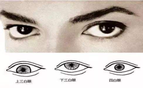 什么是三白眼图片，近视眼都是三白眼