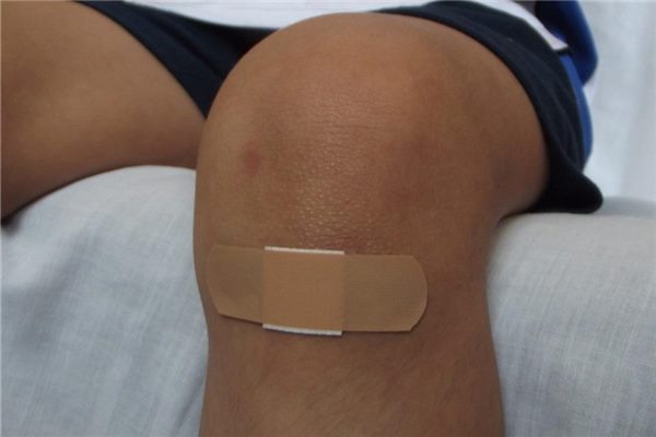 梦见结痂是啥预兆解梦（梦见伤口厚厚结痂被揭掉）