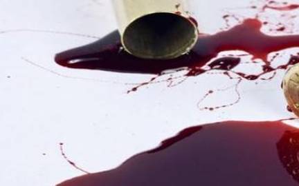 梦见头流血 梦见头流血