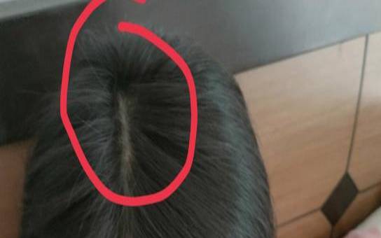 梦见洗头后掉头发 梦见洗头后掉头发