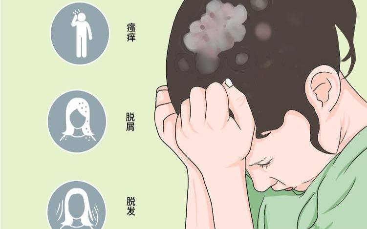 梦见头癣 梦见头癣