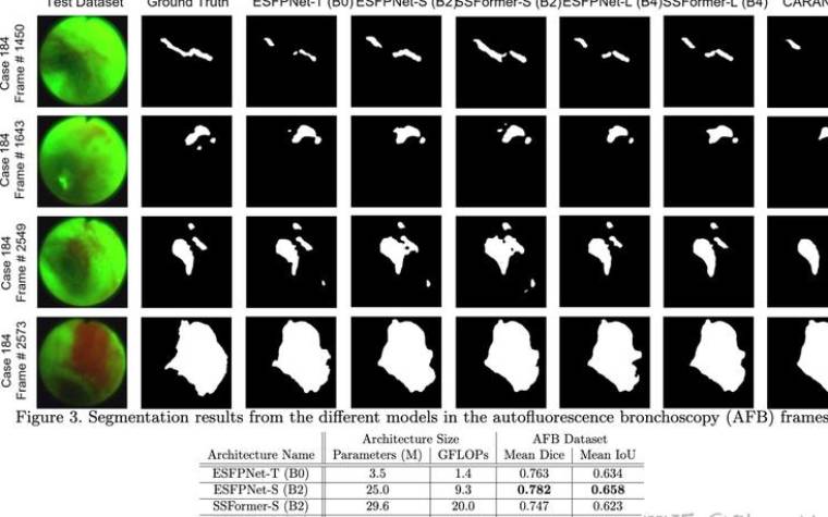 esfpa和esfpt的区别,esfpa和什么人格最配 esfpa和esfpt的区别,esfpa和什么人格最配