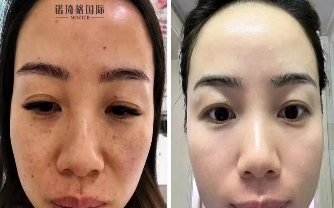 测婚后你会变漂亮吗（测你骨子里是哪种女人）
