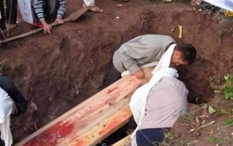 梦见死人咬我一口（做梦梦到死人咬我手）