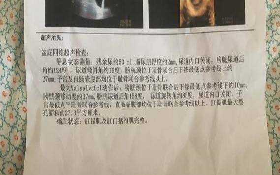 梦见膀胱掉出来了（膀胱有东西是什么征兆）