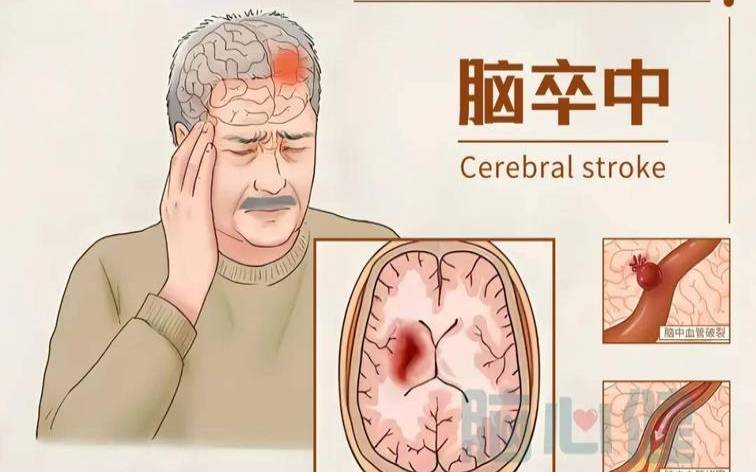 梦见脑子大脑出问题了（梦见自己脑部疾病）