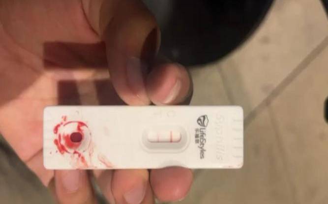 被别人传染梅毒怎么办（测测你能躲过小人吗）