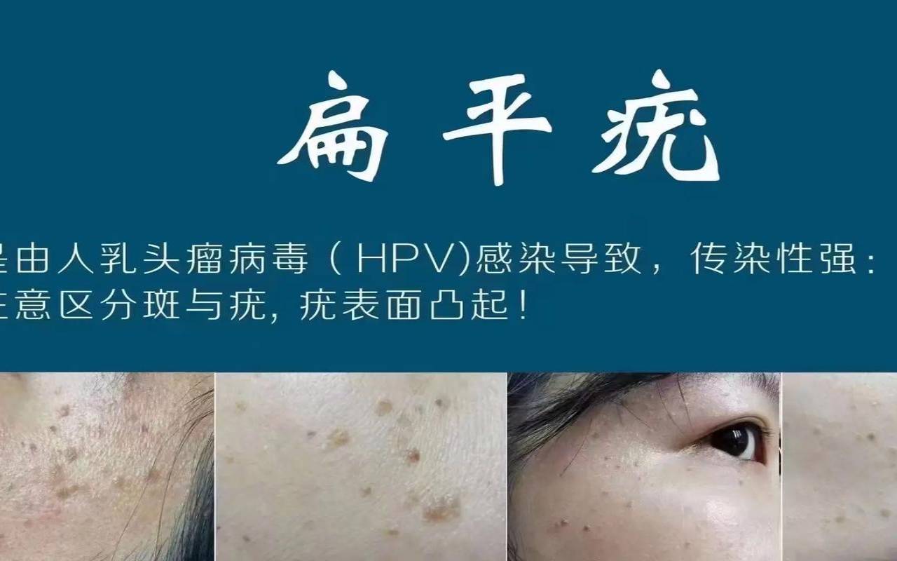 梦见乳头掉落是吉兆（梦见女人乳头是什么兆头）