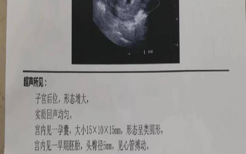 梦见打胎是什么预兆,梦见打胎了是什么征兆 梦见打胎是什么预兆,梦见打胎了是什么征兆