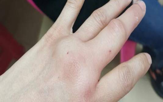 梦见被蝙蝠咬了脖子（男人梦见蝙蝠什么预兆）