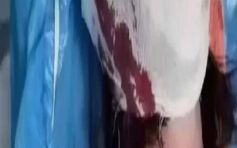 梦到挨打流血是什么意思（女人梦到别人打架流血）