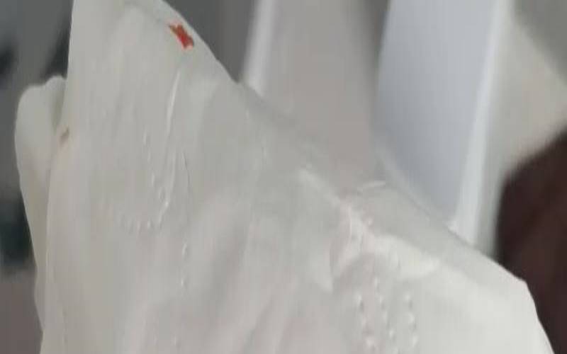 男人梦见自己头流血,头出血了怎么办