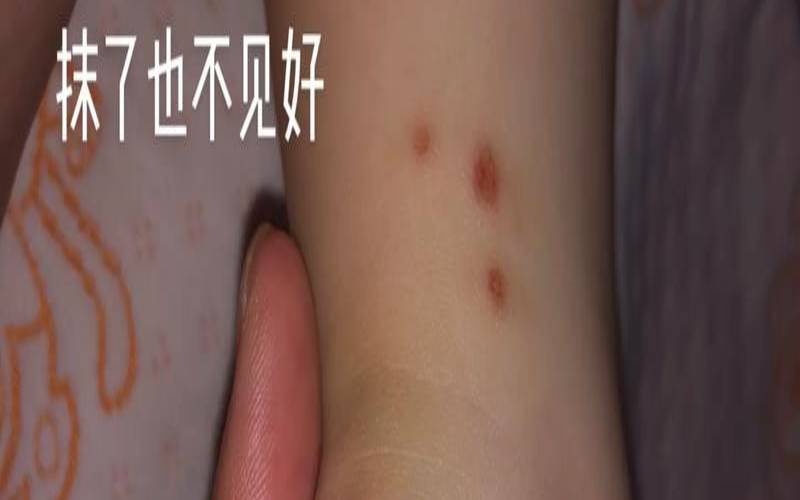 梦见爱人身上长满水泡,梦见亲人光着全身好吗