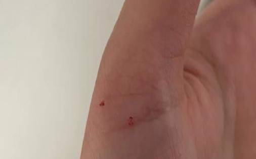 梦见被猫咬一口把猫杀了（做梦被猫咬手出血了）