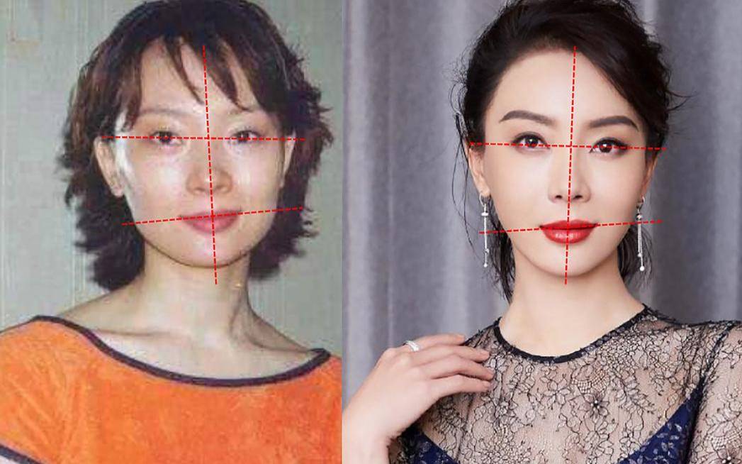 整容能改变命运吗,整容面相能改变命运吗