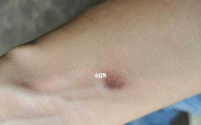 梦见被鹅追咬（梦见被鹅追咬是什么意思）