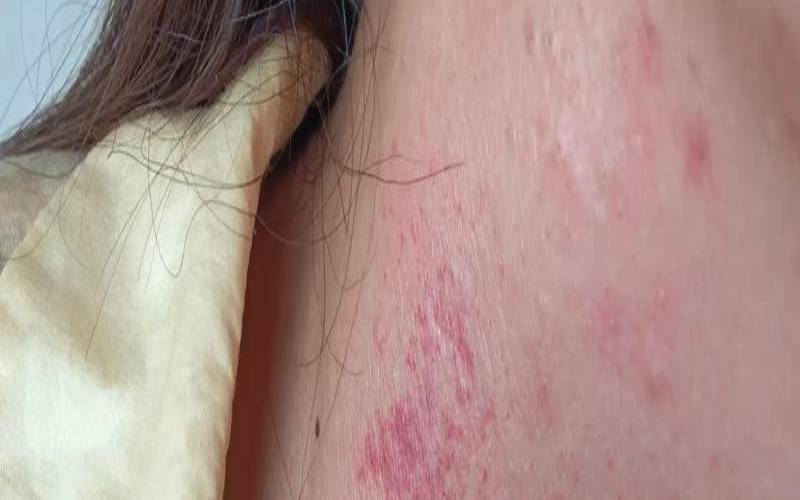 梦见老鼠咬我（梦见老鼠咬我屁股）