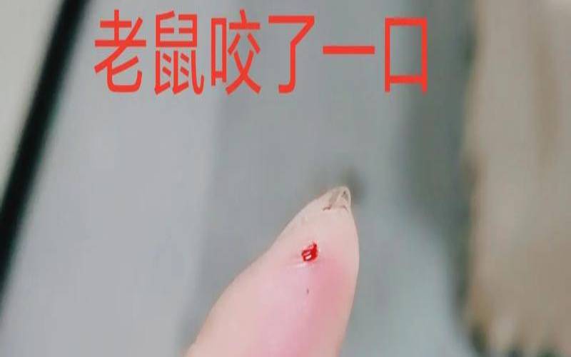 梦见老鼠咬我手（梦见老鼠咬我手怎么回事）