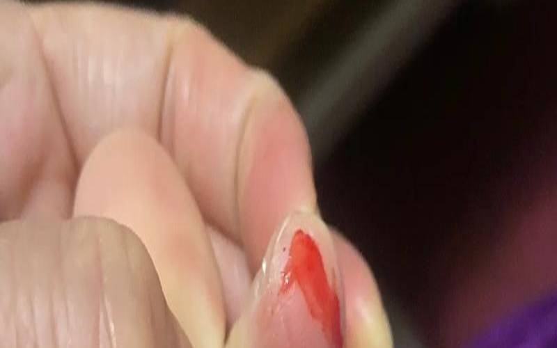 梦见被老鼠咬（梦见被老鼠咬了是什么预兆）